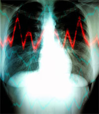 xray-heart-200.jpg