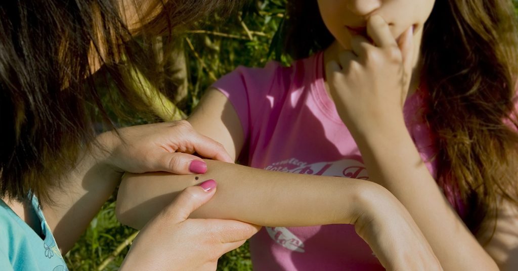 People looking at wood tick embedded in human skin