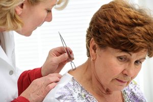 Doctor removing a tick from a patient's neck.